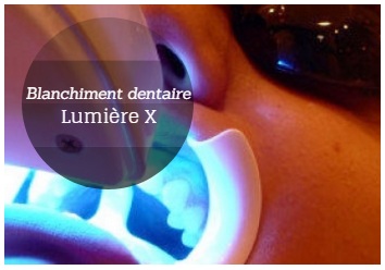 lumiere x blanchiment dentaire tunisie