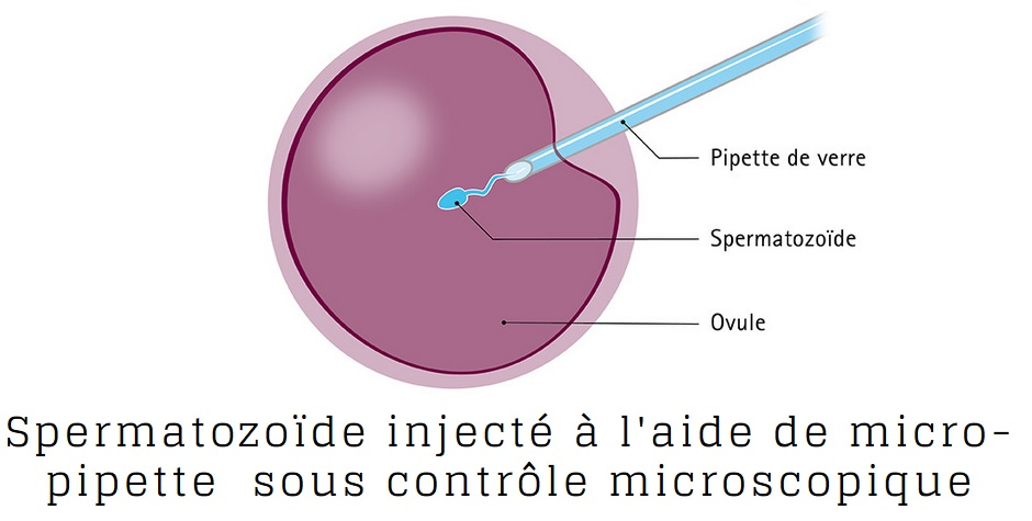 Invitro Tunisie