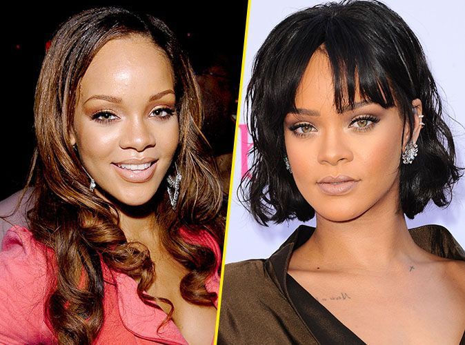 Rihanna-avant-apres-rhinoplastie - Medespoir