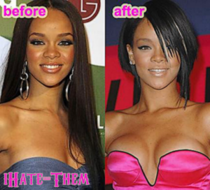 Rihanna seins avant après