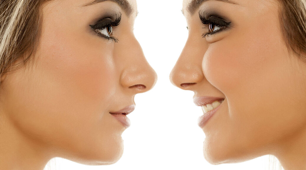 rhinoplastie Zurich