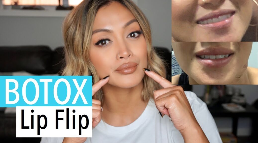 Botox lip flip