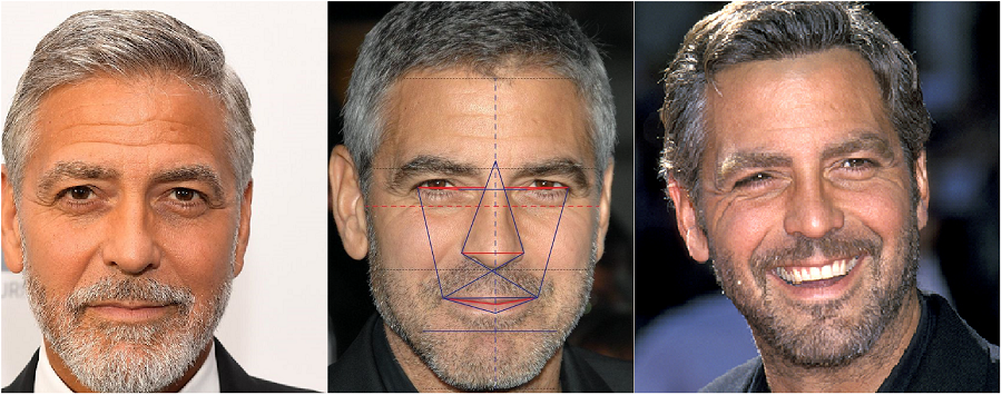 Georges Clooney chirurgie esthétique