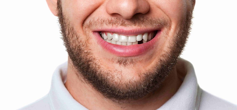 dent manquante os