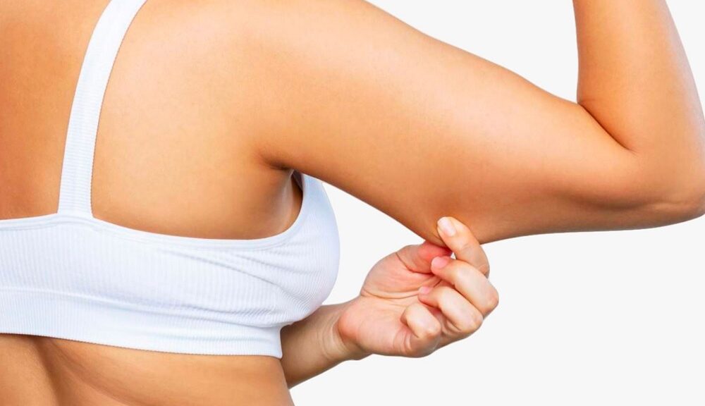 brachioplastie Suisses