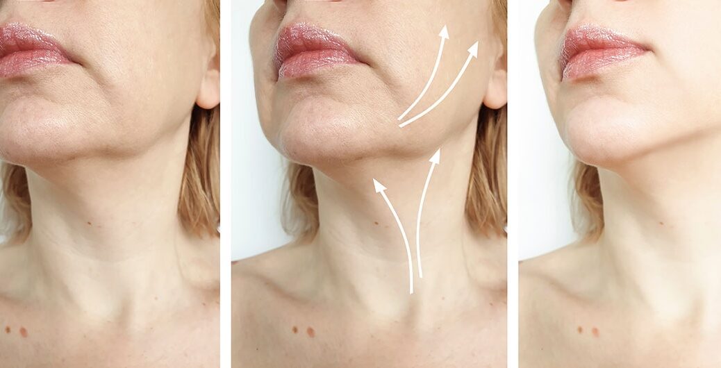 chirurgie menton Suisses