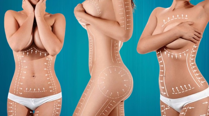 lipo 360 pour Suisses