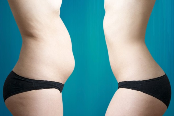 prix chirurgie abdomen