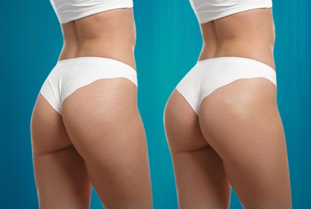 augmentation fesses prix pour Suisses