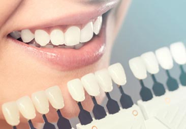 Veneers zahnmedizin tunesien