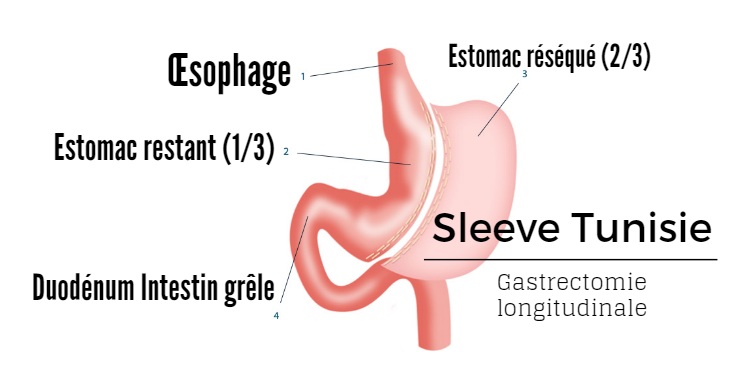 sleeve tunesien