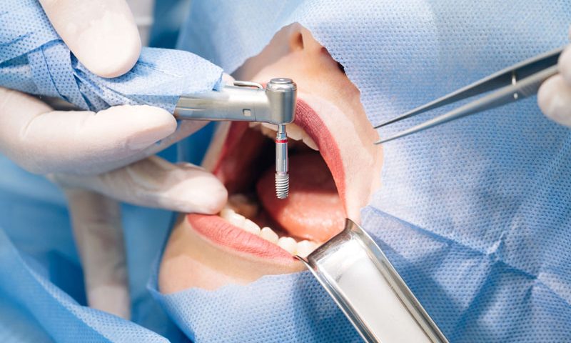 guide chirurgies soins dentaires pour suisses en Tunisie