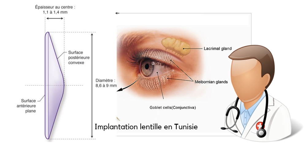 Nach der Implantation: klares Sehen ohne Brille