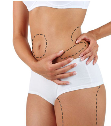 liposuction tunesien