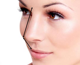 Rhinoplastie tunisie