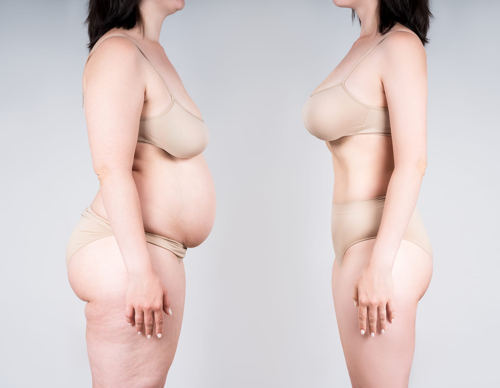 Mommy makeover pour Suisses en Tunisie 