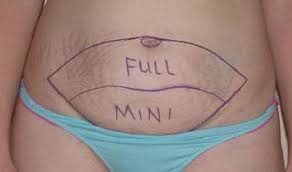 abdominoplastia Tunísia